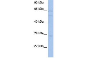PRKAA1 antibody used at 1 ug/ml to detect target protein. (PRKAA1 anticorps  (Middle Region))