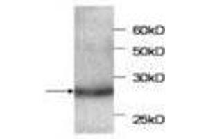 Image no. 1 for anti-serpin Peptidase Inhibitor, Clade B (Ovalbumin), Member 4 (SERPINB4) antibody (ABIN791516) (SERPINB4 anticorps)