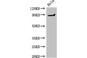 Western Blot Positive WB detected in: Hela whole cell lysate All lanes: PDE2A antibody at 2 μg/mL Secondary Goat polyclonal to rabbit IgG at 1/50000 dilution Predicted band size: 106, 104, 105, 79, 88 kDa Observed band size: 88 kDa (PDE2A anticorps  (AA 15-226))