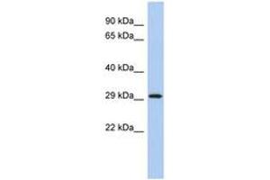 Image no. 1 for anti-14-3-3 epsilon (YWHAE) (C-Term) antibody (ABIN6744347)