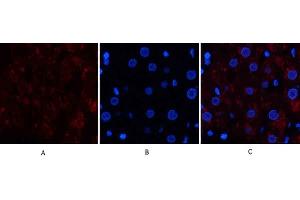 Immunofluorescence analysis of human liver tissue. (Catalase anticorps  (C-Term))