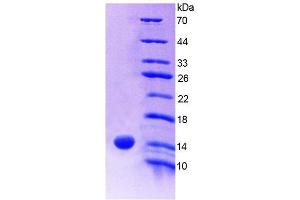 SDS-PAGE of Protein Standard from the Kit  (Highly purified E.