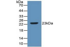 Detection of Recombinant IL2, Mouse using Polyclonal Antibody to Interleukin 2 (IL2) (IL-2 anticorps  (AA 10-169))