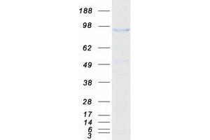 Validation with Western Blot