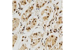 Immunohistochemistry of paraffin-embedded human stomach using NFATC1 antibody at dilution of 1:200 (x400 lens). (NFATC1 anticorps)