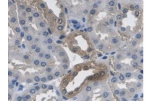 Detection of PCYOX1 in Mouse Kidney Tissue using Polyclonal Antibody to Prenylcysteine Oxidase 1 (PCYOX1)