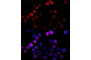 Immunofluorescence analysis of HeLa cells using Aromatase (CYP19) antibody (2684) at dilution of 1:100 (40x lens). (Aromatase anticorps  (AA 1-180))