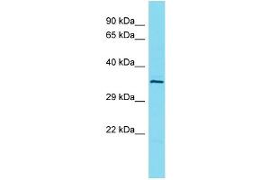 Host: Rabbit Target Name: L3HYPDH Sample Type: OVCAR-3 Whole Cell lysates Antibody Dilution: 1. (L3HYPDH anticorps  (C-Term))
