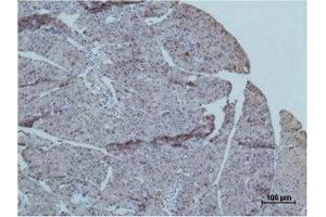 Immunohistochemical analysis of paraffin-embedded Mouse PancreasTissue using TRIM72 Polyclonal Antibody. (TRIM72 anticorps)