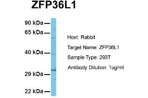 Host: Rabbit Target Name: ZFP36L1 Sample Tissue: Human 293T Antibody Dilution: 1. (ZFP36L1 anticorps  (N-Term))