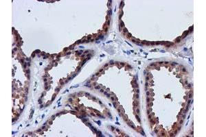 Immunohistochemical staining of paraffin-embedded Human breast tissue using anti-LACTB2 mouse monoclonal antibody. (LACTB2 anticorps  (AA 78-288))