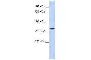 ANP32B antibody used at 1 ug/ml to detect target protein. (ANP32B anticorps)