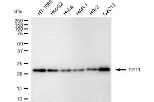 Western blotting analysis using TPT1 antibody (ABIN7800695).