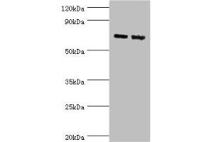 Western blot All lanes: Amyloid-like protein 1 antibody at 6 μg/mL Lane 1: Mouse brain tissue Lane 2: A549 whole cell lysate Secondary Goat polyclonal to rabbit IgG at 1/10000 dilution Predicted band size: 72 kDa Observed band size: 72 kDa (APLP1 anticorps  (AA 39-300))