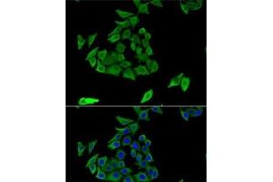 Immunofluorescence analysis of U2OS cells using TGM3 Polyclonal Antibody (TGM3 anticorps)