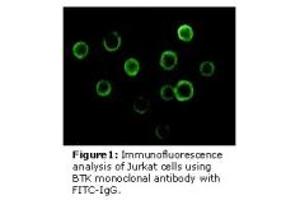 Image no. 3 for anti-Bruton Agammaglobulinemia tyrosine Kinase (BTK) antibody (ABIN232137) (BTK anticorps)