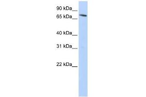 SLC11A2 antibody used at 1 ug/ml to detect target protein. (SLC11A2 anticorps  (N-Term))