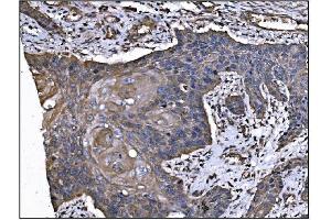 IHC analysis of TGFBR2 using anti-TGFBR2 antibody (ABIN7603157).