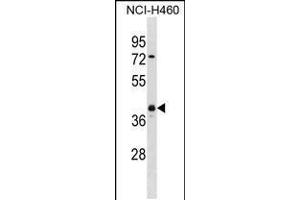 Western blot analysis in NCI-H460 cell line lysates (35ug/lane). (UCHL5 anticorps  (AA 136-164))