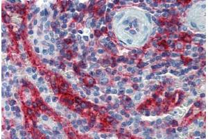 Spleen, Human: Formalin-Fixed, Paraffin-Embedded (FFPE) (HLA-E anticorps)