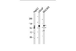 All lanes : Anti-ANO7 Antibody (N-term) at 1:2000 dilution Lane 1: HepG2 whole cell lysate Lane 2: LNCaP whole cell lysate Lane 3: MG whole cell lysate Lysates/proteins at 20 μg per lane. (Anoctamin 7 anticorps  (N-Term))