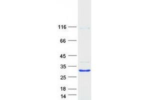 Validation with Western Blot