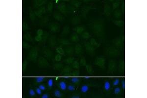 Immunofluorescence analysis of U2OS cells using ATP1A1 Polyclonal Antibody at dilution of 1:100. (ATP1A1 anticorps)