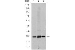 Western blot analysis using EIF4E mouse mAb against Hela (1), HEK293 (2) and K562 (3) cell lysate. (EIF4E anticorps)