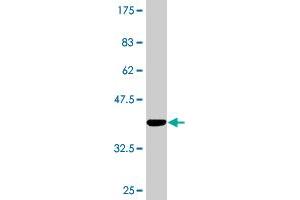 Western Blot detection against Immunogen (37.