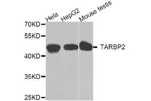Western blot analysis of extracts of various cell lines, using TARBP2 antibody. (TARBP2 anticorps  (AA 1-366))