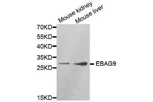 Western blot analysis of extracts of various cell lines, using EBAG9 antibody. (RCAS1 anticorps  (AA 28-213))