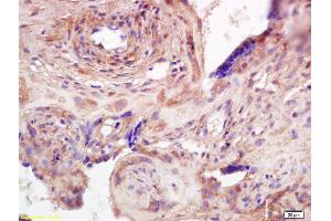Formalin-fixed and paraffin embedded human placenta labeled with Anti-ADAMTS7 Polyclonal Antibody, Unconjugated (ABIN668586) at 1:200 followed by conjugation to the secondary antibody and DAB staining