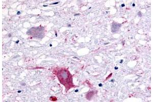 Immunohistochemistry (Formalin/PFA-fixed paraffin-embedded sections) of human brain, neurons and glia with GPR32 polyclonal antibody . (GPR32 anticorps  (3rd Extracellular Domain))