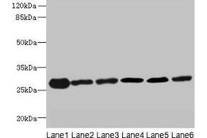 Western blot All lanes: TMED9 antibody at 4. (TMED9 anticorps  (AA 40-197))
