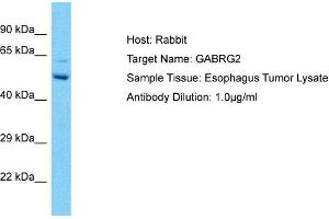 Host: Rabbit Target Name: GABRG2 Sample Type: Esophagus Tumor lysates Antibody Dilution: 1. (GABRG2 anticorps  (N-Term))