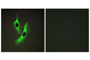 Immunofluorescence (IF) image for anti-STEAP Family Member 4 (STEAP4) (Internal Region) antibody (ABIN1849702) (STEAP4 anticorps  (Internal Region))