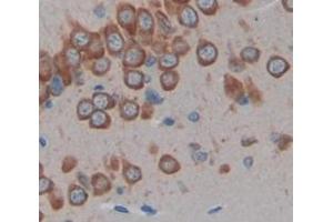 Figure. (HDC anticorps  (AA 365-643))