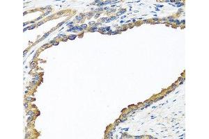 Immunohistochemistry of paraffin-embedded Human prostate using NYX Polyclonal Antibody at dilution of 1:100 (40x lens). (Nyctalopin anticorps)