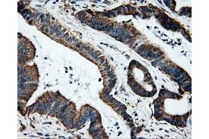 Immunohistochemical staining of paraffin-embedded Kidney tissue using anti-HSD17B10mouse monoclonal antibody. (HSD17B10 anticorps)