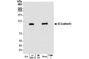 Western Blotting (WB) image for anti-Cadherin 1, Type 1, E-Cadherin (Epithelial) (CDH1) (AA 155-707) antibody (ABIN7454024)
