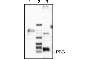 Image no. 1 for anti-Porphobilinogen-Deaminase (PBG) (HemC ) antibody (ABIN334586) (Porphobilinogen-Deaminase (PBG) (HemC ) anticorps)