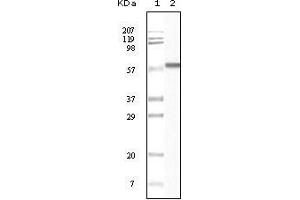 Western Blot showing CK1 antibody used against truncated CK1 recombinant protein. (CSNK1A1 anticorps)