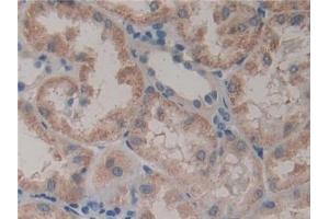 Detection of GSTt2 in Human Kidney Tissue using Polyclonal Antibody to Glutathione S Transferase Theta 2 (GSTt2)