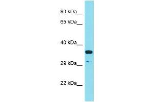 Host: Rabbit Target Name: RSPO3 Sample Type: HT1080 Whole Cell lysates Antibody Dilution: 1. (R-Spondin 3 anticorps  (C-Term))