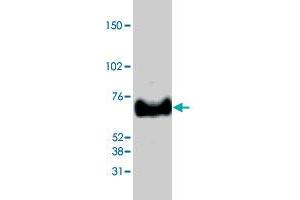 Western blot analysis from 40 ug HeLa nuclear extracts using MECP2 polyclonal antibody  at 1:1000 dilution. (MECP2 anticorps  (C-Term))