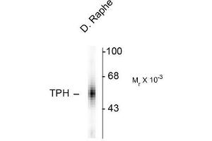 Image no. 1 for anti-Tryptophan Hydroxylase 1 (TPH1) antibody (ABIN372730) (Tryptophan Hydroxylase 1 anticorps)