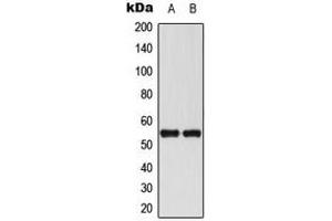 Western blot analysis of RUNX1 expression in THP1 (A), Jurkat (B) whole cell lysates. (RUNX1 anticorps  (Center))