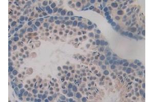 Detection of TTK in Mouse Testis Tissue using Polyclonal Antibody to TTK Protein Kinase (TTK)