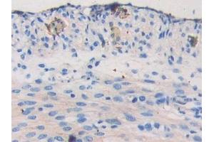 Detection of NEXN in Mouse Uterus Tissue using Polyclonal Antibody to Nexilin (NEXN)