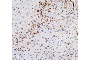 IHC analysis of RET using anti-RET antibody (ABIN6719502). (Ret Proto-Oncogene anticorps  (AA 29-304))